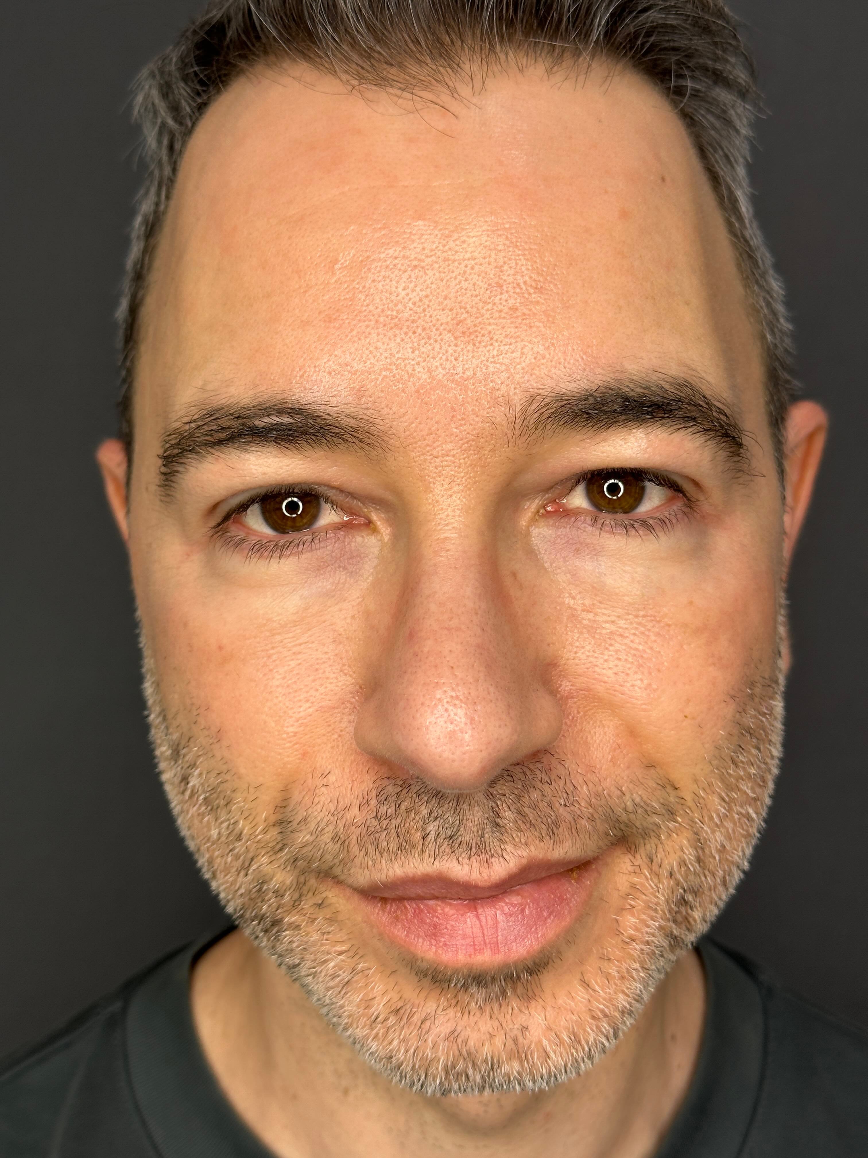 Facial Contouring before