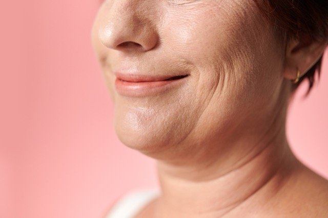 Sagging Skin & Jowls Treatment